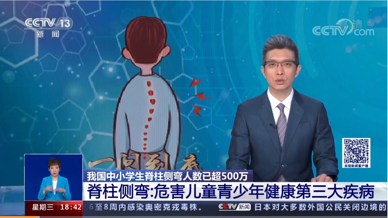 青少年脊柱側(cè)彎現(xiàn)狀堪憂(yōu)